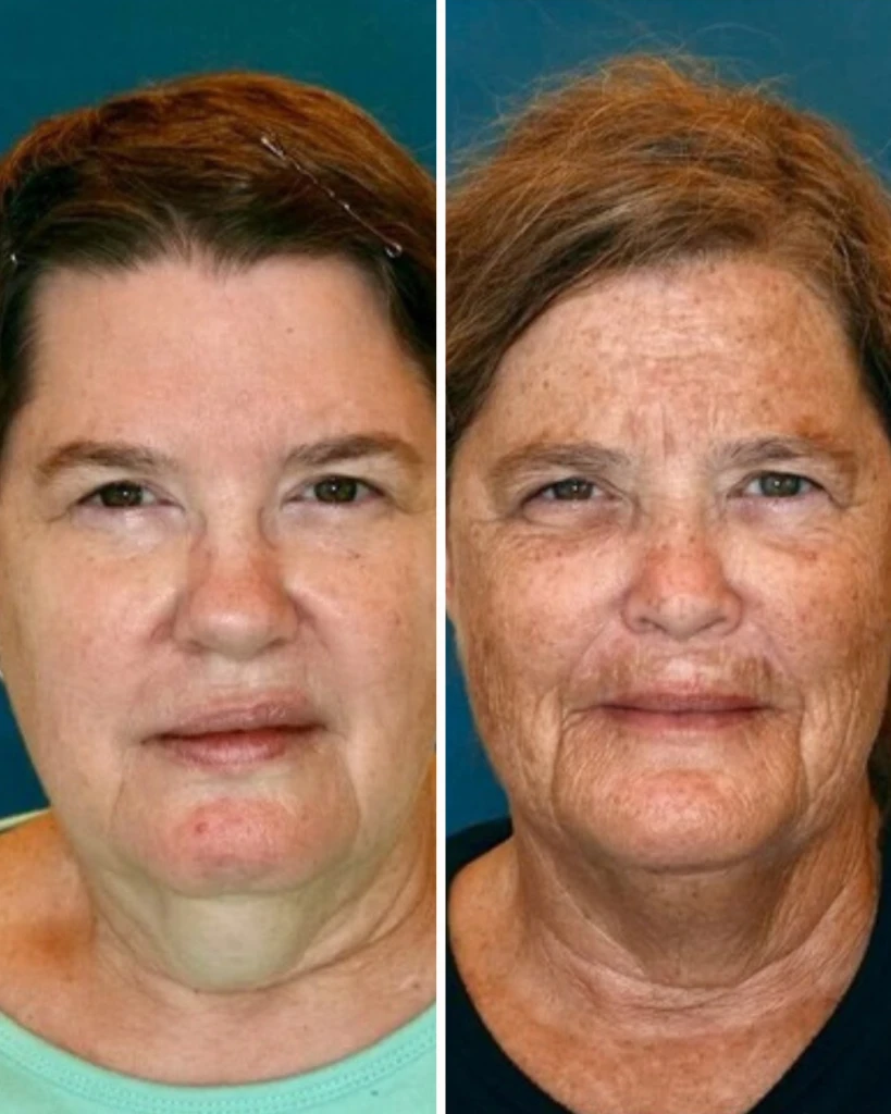 Пост 2 (93).png Пост 2 (93).png