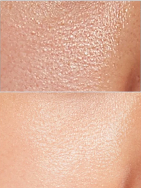 Эмульсия с ласточкиным гнездом и гиалуроновой кислотой ESTHETIC HOUSE Ultra Hyaluronic Acid Bird's Nest Emulsion