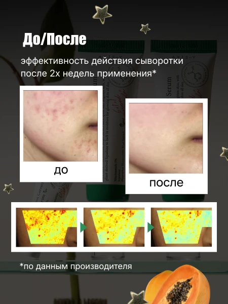 Осветляющая сыворотка с ниацинамидом AXIS-Y Dark Spot Correcting Glow Serum