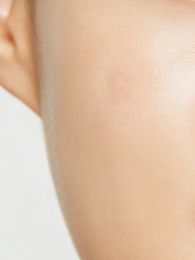 Патчи против воспалений COSRX Clear Fit Master Patch