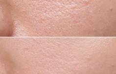 Мужской тонер для лица ESTHETIC HOUSE Monz Perfect Defence Toner