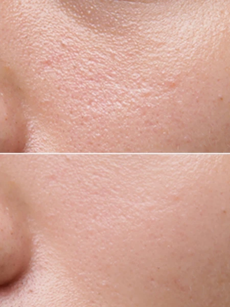 Мужской тонер для лица ESTHETIC HOUSE Monz Perfect Defence Toner