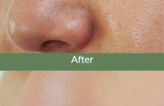 Жидкая маска для очищения сальных нитей Dr.Althea Premium Quick Step Sebum Cleanser