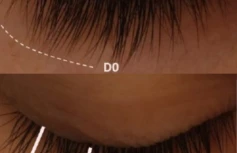 Питательная сыворотка для роста ресниц с пептидами Derma Factory Peptide Eyelash Ampoule