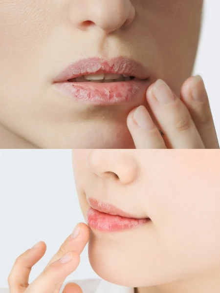 Восстанавливающая сыворотка для губ с керамидами Ma:nyo Factory Treatment Lip Serum