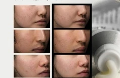 Восстанавливающий крем для лица с ниацинамидом Dr.Althea 345 Relief Cream