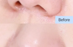 Освежающий гидрофильный бальзам-точилка с гвайазуленом Dr.Althea Pore Refresh Grinding Cleansing Balm