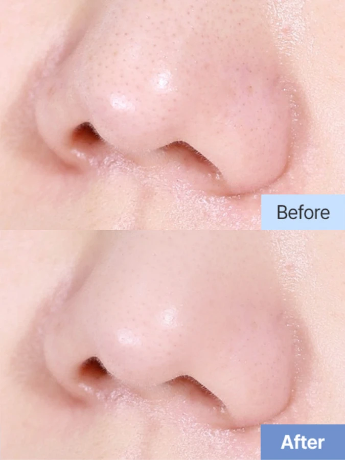 Освежающий гидрофильный бальзам-точилка с гвайазуленом Dr.Althea Pore Refresh Grinding Cleansing Balm