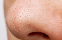 Очищающее гидрофильное масло с экстрактом хауттюйнии TRAVEL ANUA Heartleaf Pore Control Cleansing Oil