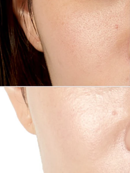 Тонер с ласточкиным гнездом и гиалуроновой кислотой ESTHETIC HOUSE Ultra Hyaluronic acid Bird's nest Toner