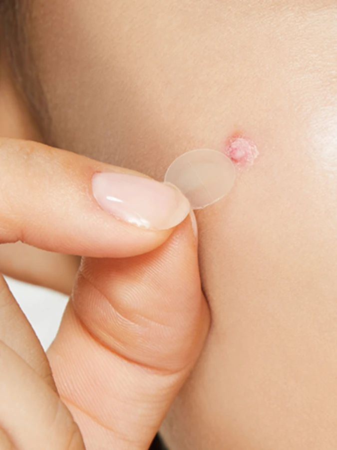 Патчи против воспалений COSRX Clear Fit Master Patch