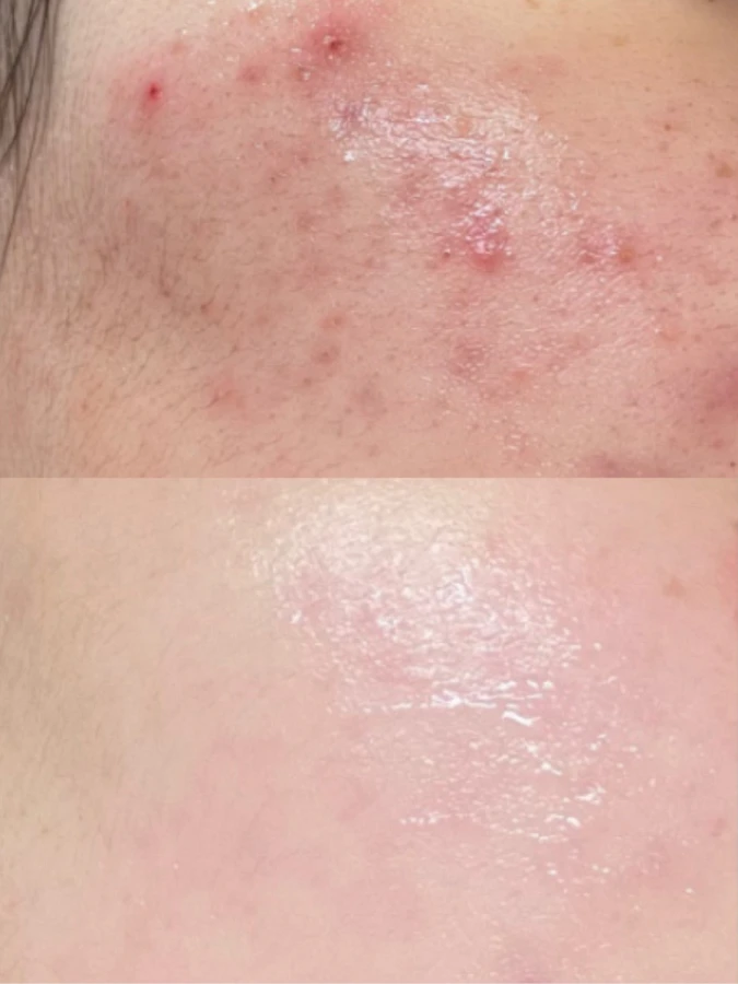 Многофункциональная успокаивающая пудра с пантотеновой кислотой Numbuzin No.1 Pantothenic B5 Active Drying Powder