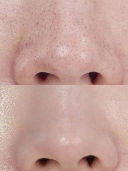 Глиняная маска-стик для глубокого очищения пор MEDI-PEEL Extra Super 9 Plus Active Stick