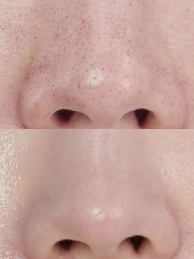 Глиняная маска-стик для глубокого очищения пор MEDI-PEEL Extra Super 9 Plus Active Stick