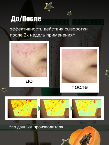 Осветляющая сыворотка с ниацинамидом AXIS-Y Dark Spot Correcting Glow Serum