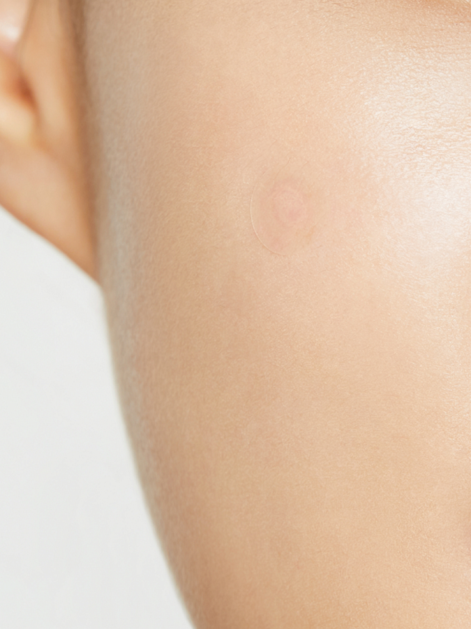 Патчи против воспалений COSRX Clear Fit Master Patch