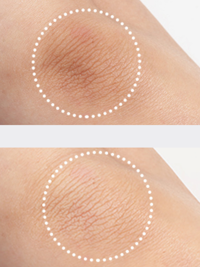 Точечная маска для осветления пигментации ESTHETIC HOUSE Vital Toning Spot Patch