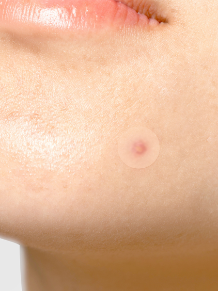 Патчи против воспалений TIAM Surprise H Patch