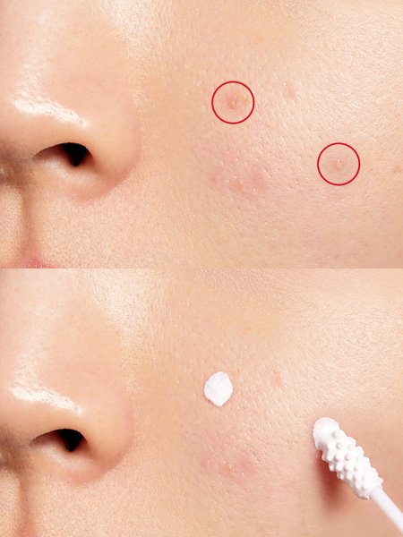 Точечное двухфазное средство против воспалений с каламином COSRX AC Collection Blemish Spot Drying Lotion Kit Точечное двухфазное средство против воспалений с каламином COSRX AC Collection Blemish Spot Drying Lotion Kit