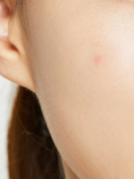Патчи против воспалений Cosrx Acne Pimple Master Patch Патчи против воспалений Cosrx Acne Pimple Master Patch
