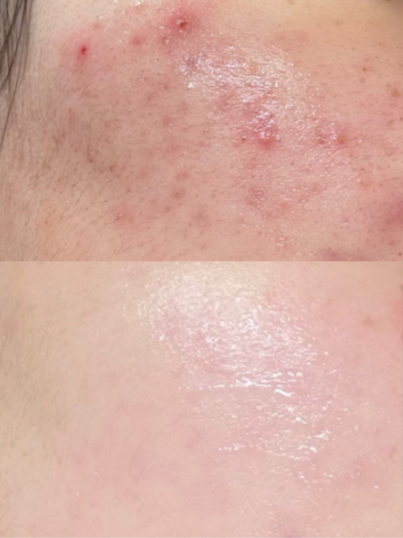 Многофункциональная успокаивающая пудра с пантотеновой кислотой Numbuzin No.1 Pantothenic B5 Active Drying Powder