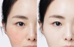 Тональный лосьон с зеленым пигментом Numbuzin No.2 Goodbye Redness ...