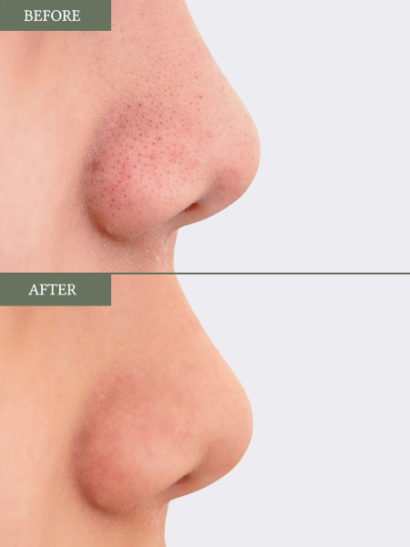 Смягчающие тонер-пэды для лица с экстрактом иерихонской розы Dr.Althea Anastatica Skin Conditioning Pad Смягчающие тонер-пэды для лица с экстрактом иерихонской розы Dr.Althea Anastatica Skin Conditioning Pad